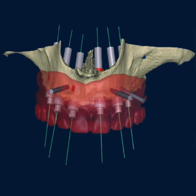 cirurgia_guiada